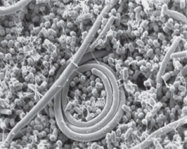 Choice of litter material can decrease Salmonella in poultry flocks