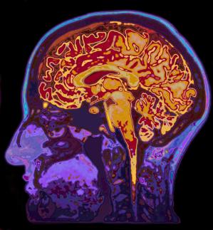 Dementia as an existential threat: the importance of self-esteem, social connectedness and meaning in life