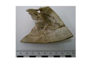 What do bones tell us? The study of human skeletons from the perspective of forensic anthropology