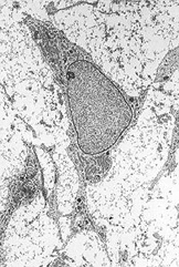 Mesenchymal Stem Cells As A Platform For Gene Therapy Protocols